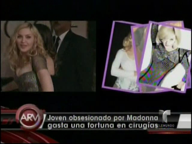 Joven Gasta Una Fortuna En Operaciones Para Parecerse A Madonna