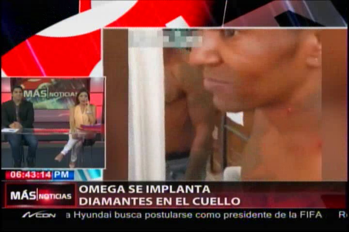 Omega Comparte Video En El Que Le Implantan Diamantes En El Cuello