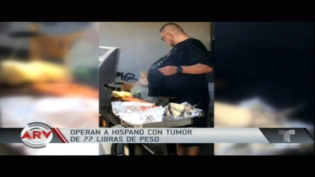 Operan A Hispano Con Tumor De 77 Libras De Su Peso