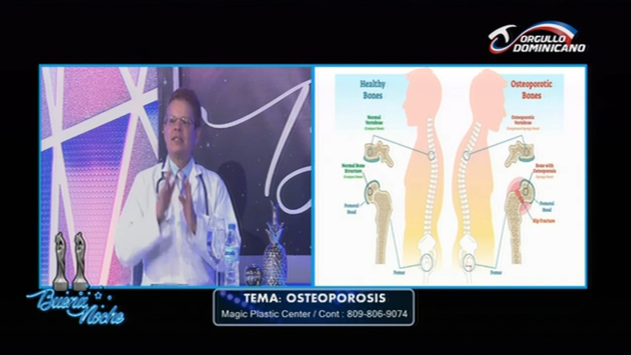 Conoce Más De La Osteoporosis Con El Dr. Santiago Núñez