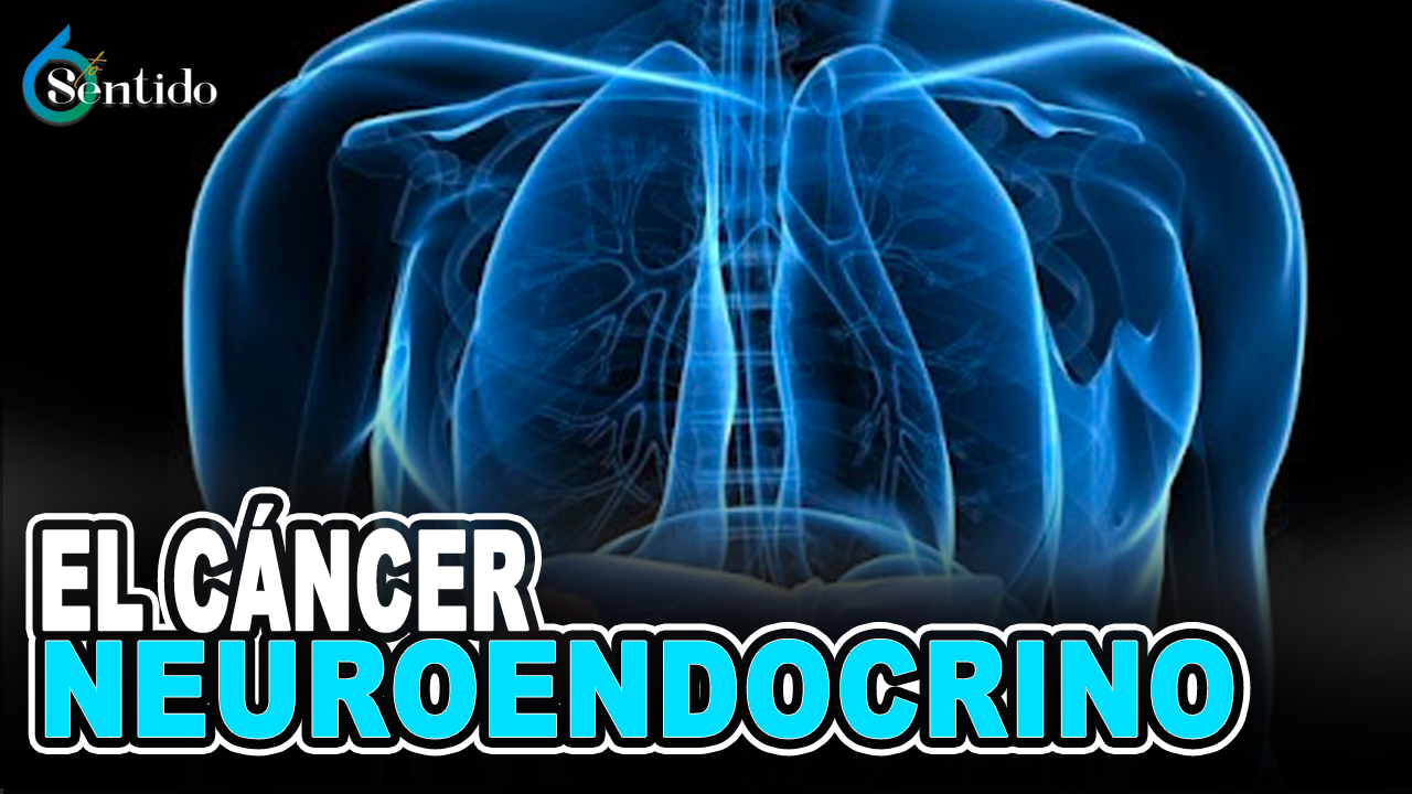 Día Internacional Contra El Cáncer Neuroendocrino (NET) | 6to Sentido