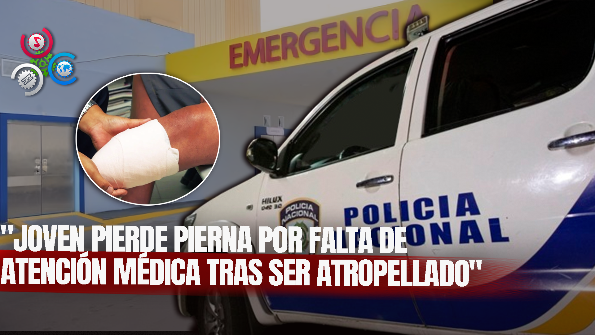 Joven Pierde Una Pierna Tras Ser Arrollado Por Una Patrulla Policial En San Cristóbal