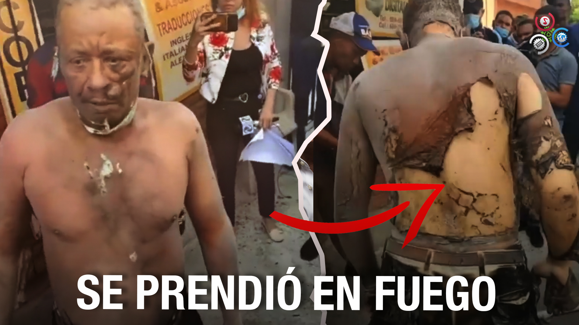 ¡Todos Los Detalles De Hombre Que Se Prendió Fuego Frente A Palacio De Justicia! | Por Esto Lo Hizo