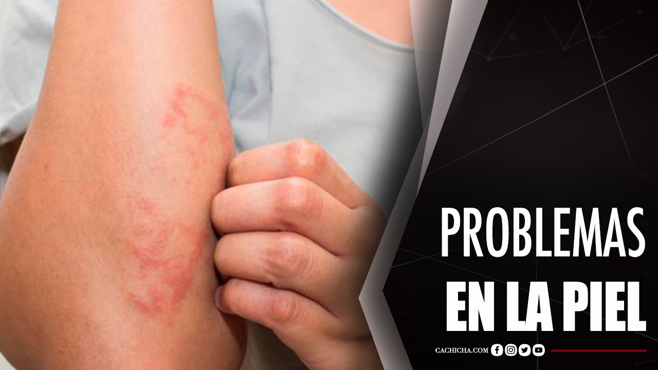 Médico Responde Preguntas Sobre Problemas En La Piel