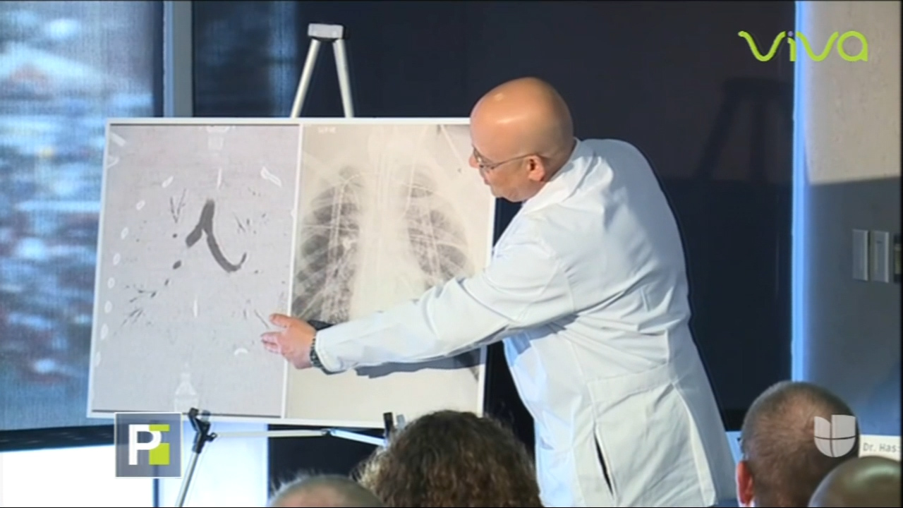 ¡VUELVEN LOS CIGARRILLOS ELECTRÓNICOS! Un Joven Casi Pierde La Vida Tras Desgarrarse Los Pulmones A Causa Del Cigarrillo Electrónico