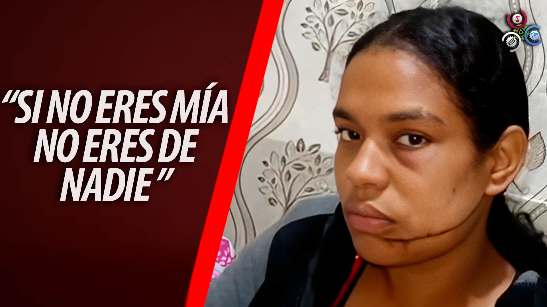 Hombre Le Propina Herida A Su EX En La Cara  “LE DIERON 185 PUNTOS”