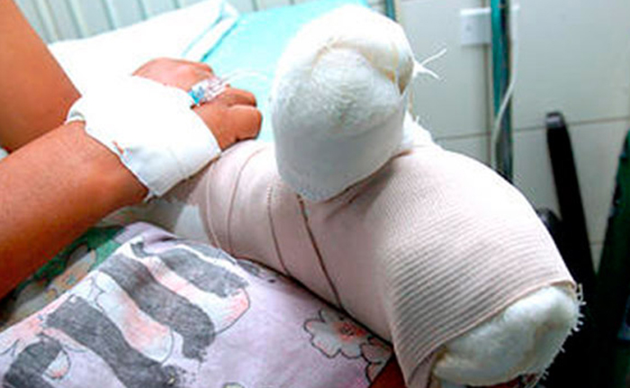 Joven Le Cercena La Mano A Su Ex Padrastro En SFM