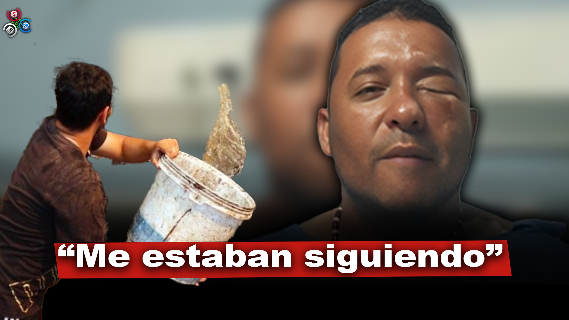 Queman Rostro De Un Candidato A Regidor Con Un Producto Químico Lanzado Desde Un Vehículo