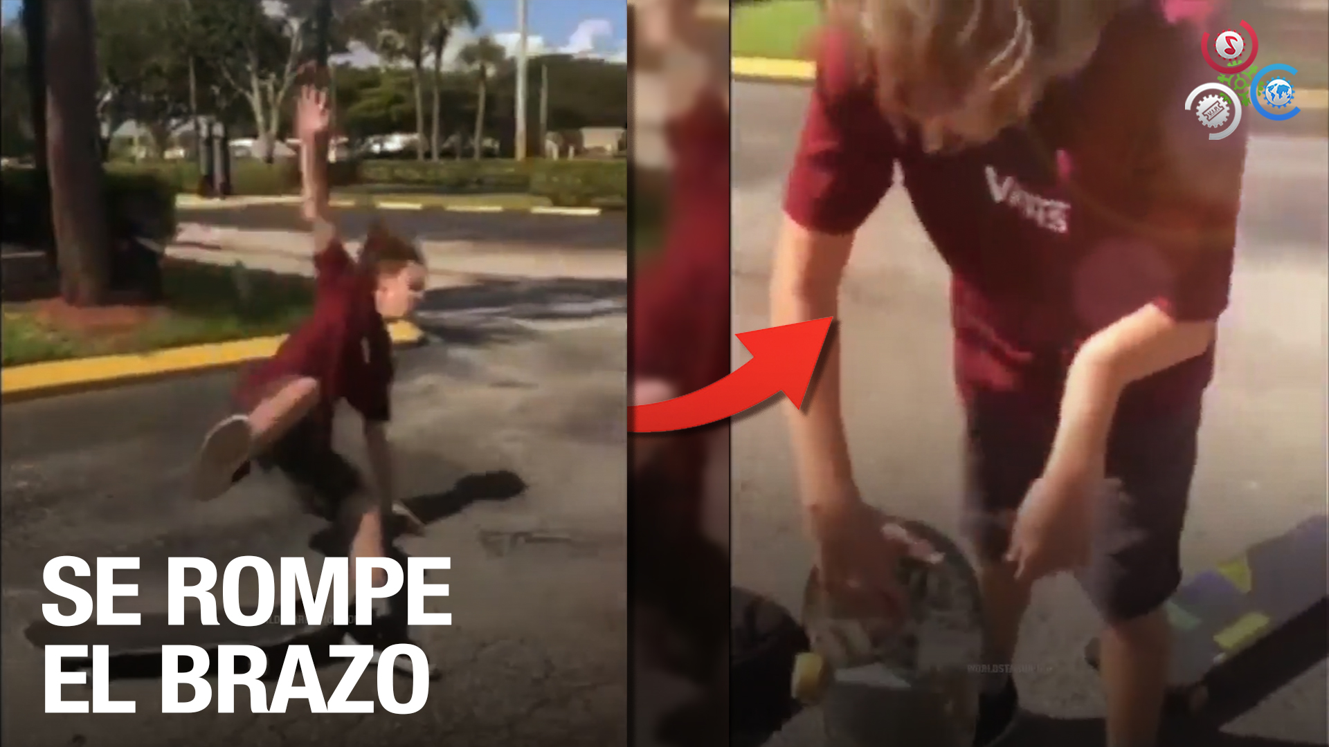 (Fuertes Imágenes) Chico Se Rompe El Brazo Montando Skateboard, Así Terminó