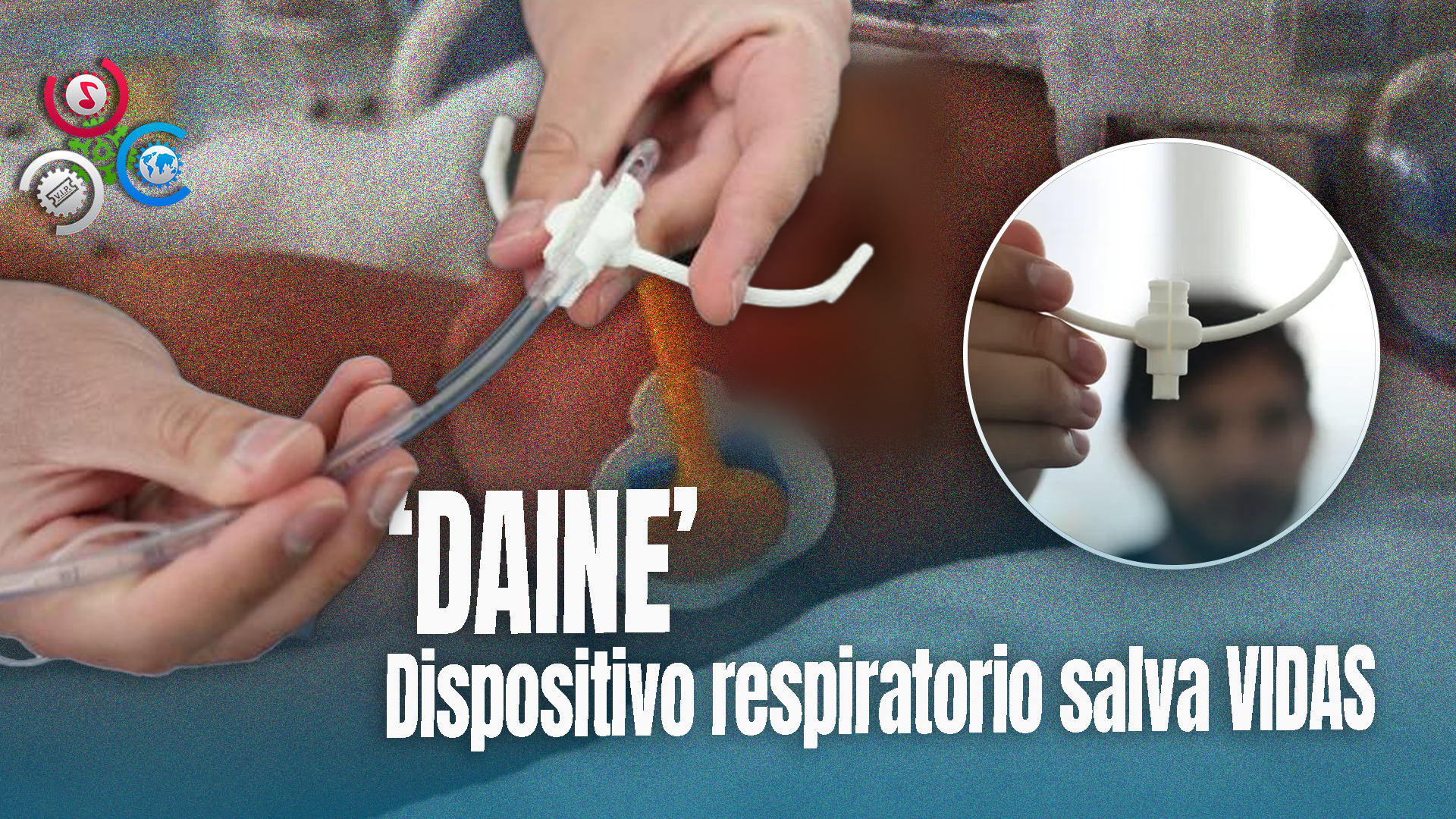 Conoce El Dispositivo Creado Por Jóvenes Bolivianos Que Ya Salvó La Vida De 100 Bebés