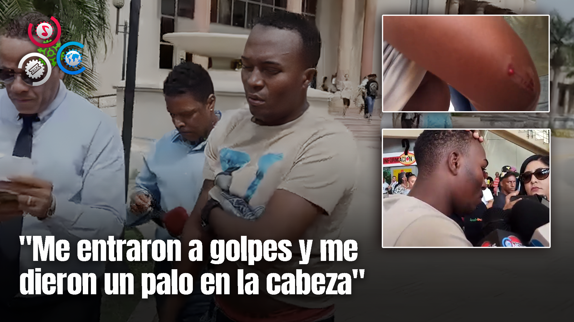 Sargento De La Policía Denuncia Que Fue Agredido Por Agentes De Migración En Santiago