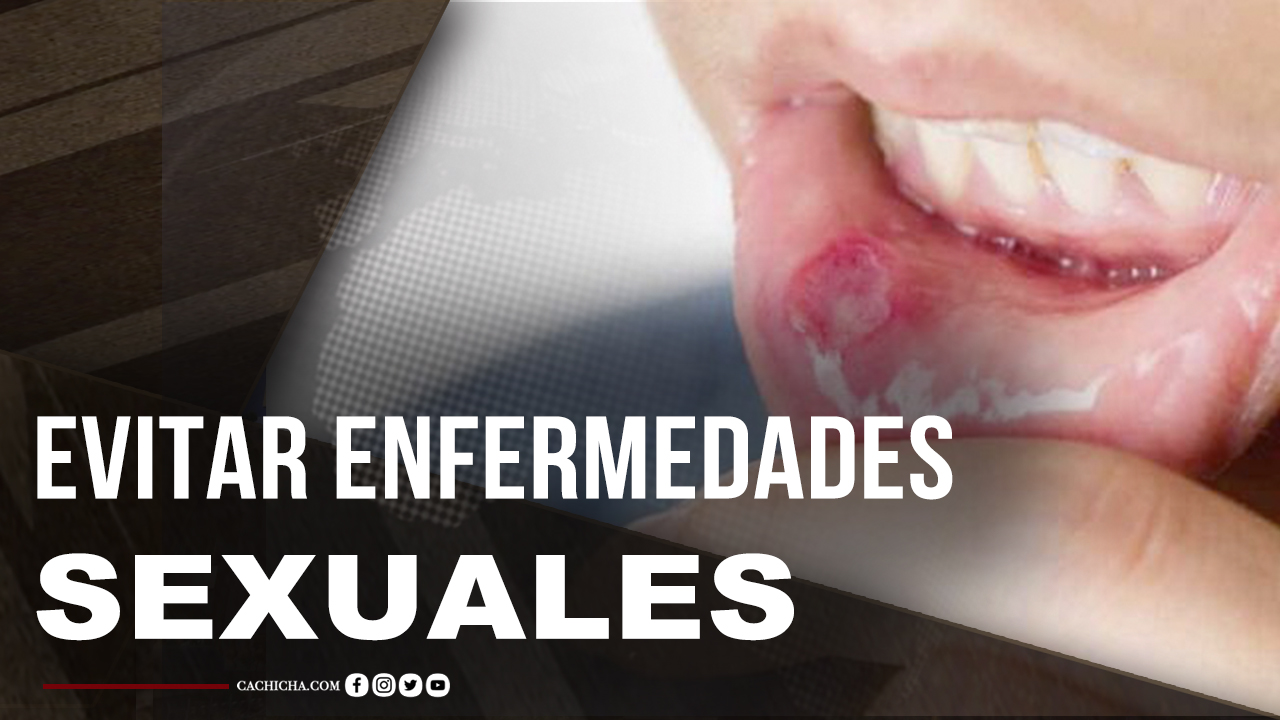 La Compulsividad Sexual, Síntomas Y Causas