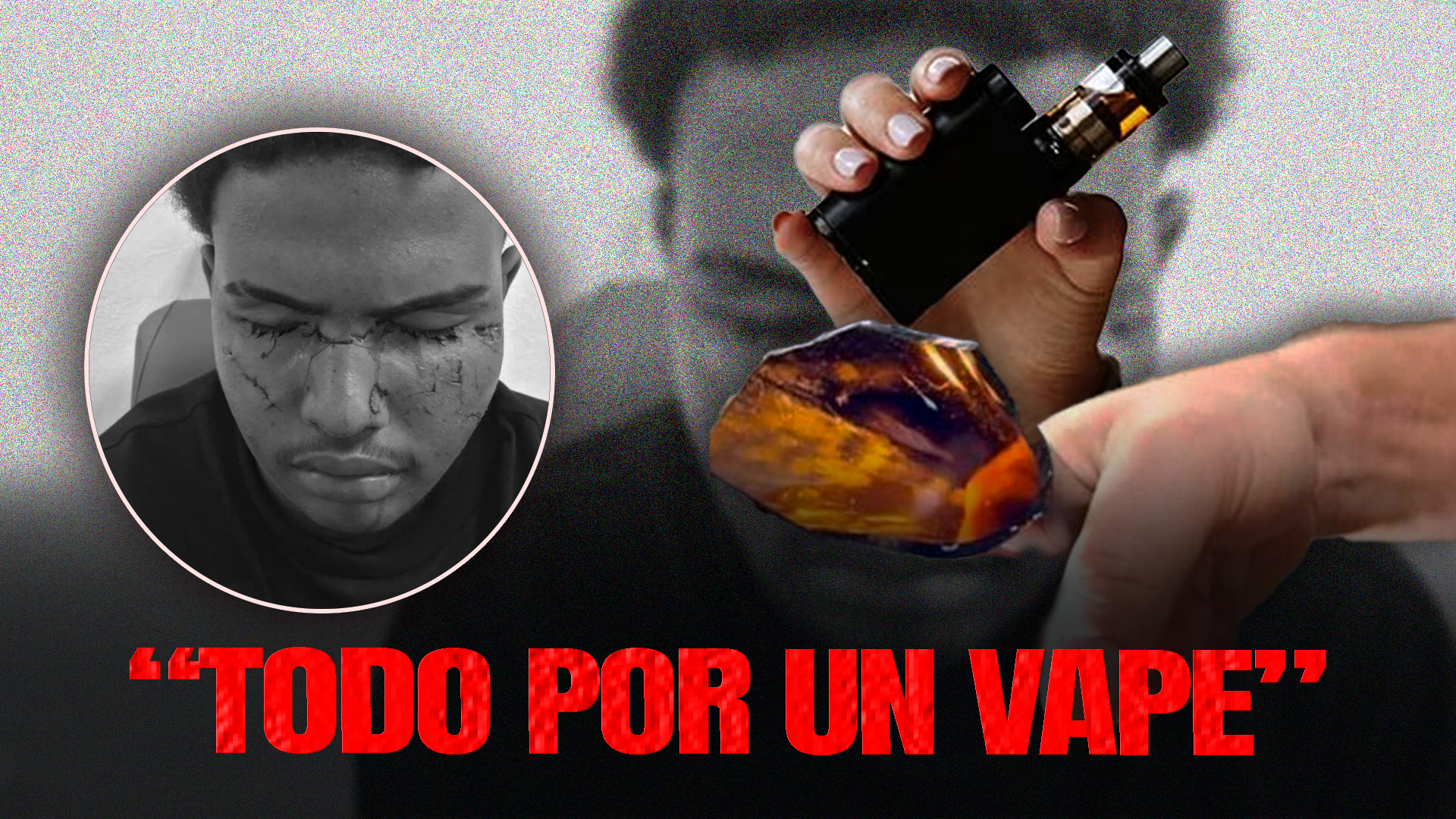 Adolescente De 15 Años Pierde La Visión Tras Recibir Un Botellazo