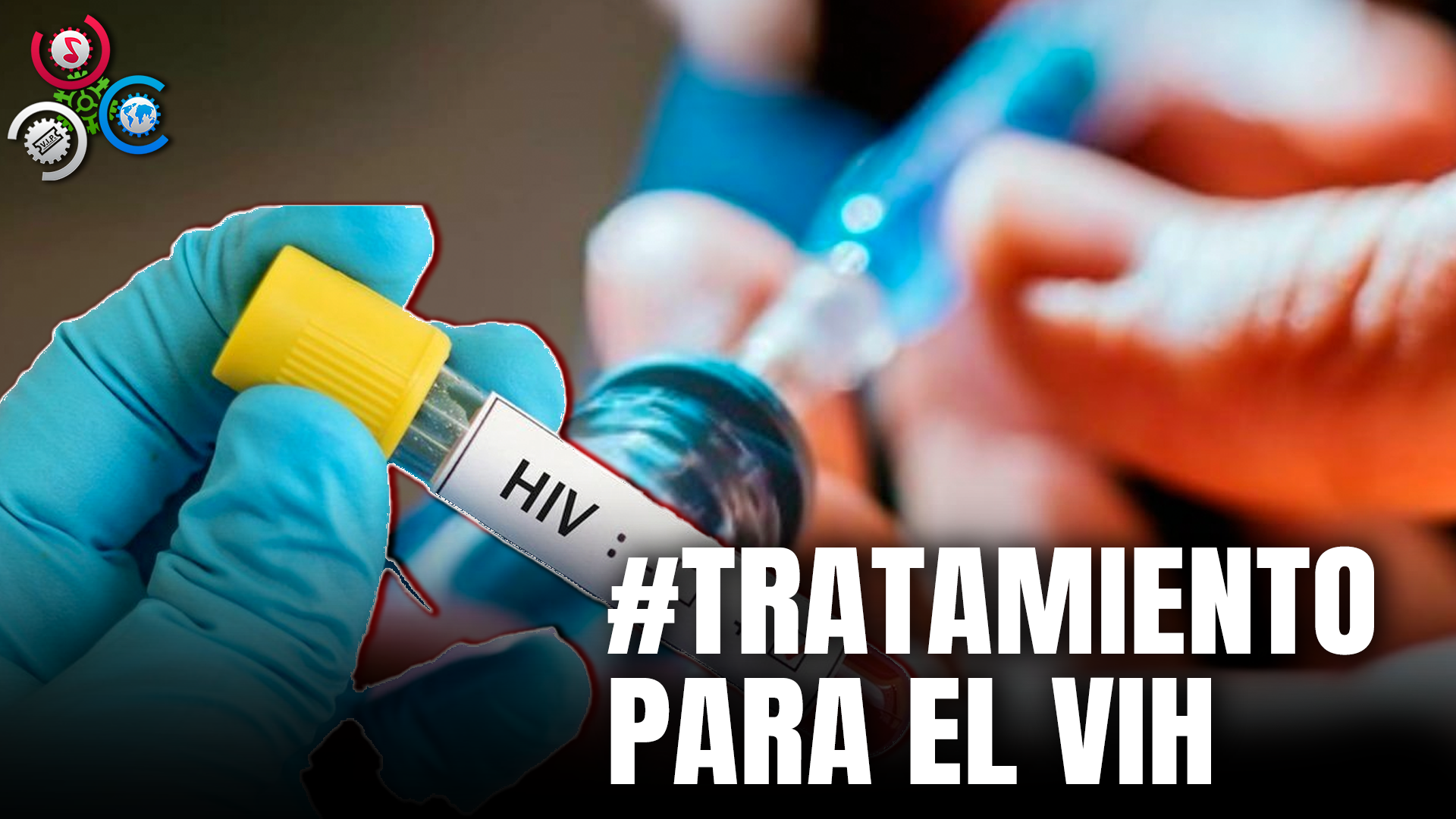 Tratamiento Inyectable Para VIH Sería Más Efectivo Que Pastillas, Según Farmacéutica