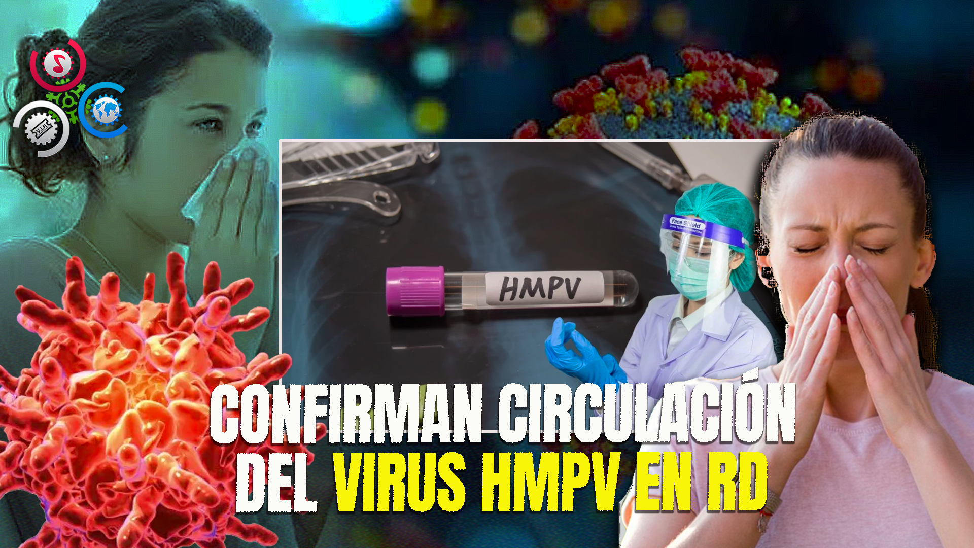 Virus HMPV Ya Circula En RD, Dice Sociedad Dominicana