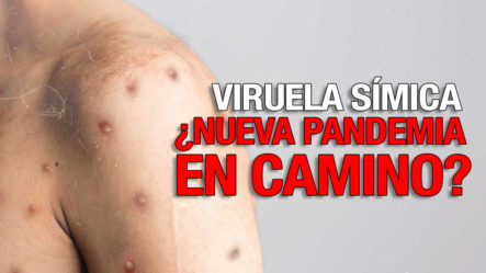 2 Casos De Viruela Del Mono En El País ¿Nueva Pandemia En Camino?