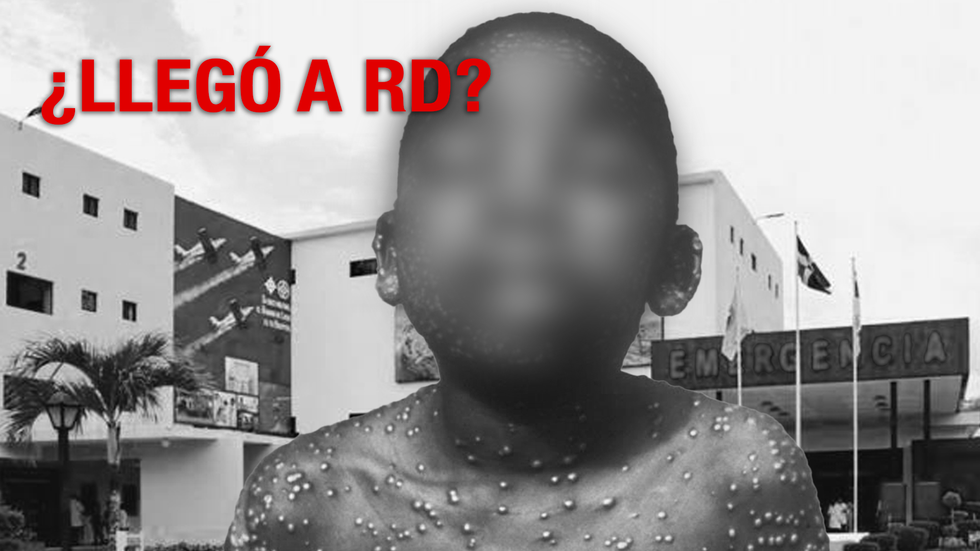 Médicos Investigan Posible Caso De Viruela Del Mono En El País