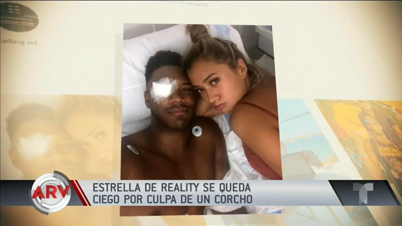 Estrella De Reality Se Queda Ciego Por Culpa De Un Corcho