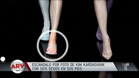 Kim Kardashian Parece Tener 6 Dedos En Un Pie.
