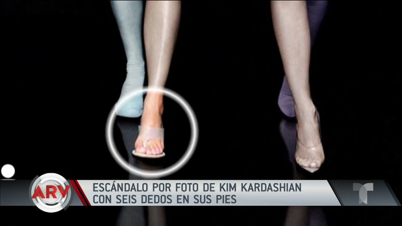 Kim Kardashian Parece Tener 6 Dedos En Un Pie.