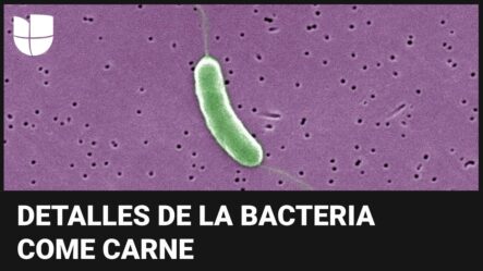 ¿Qué Se Sabe De La Bacteria ‘come Carne’ Y Cómo Los Huracanes Elevan El Riesgo De Infección?