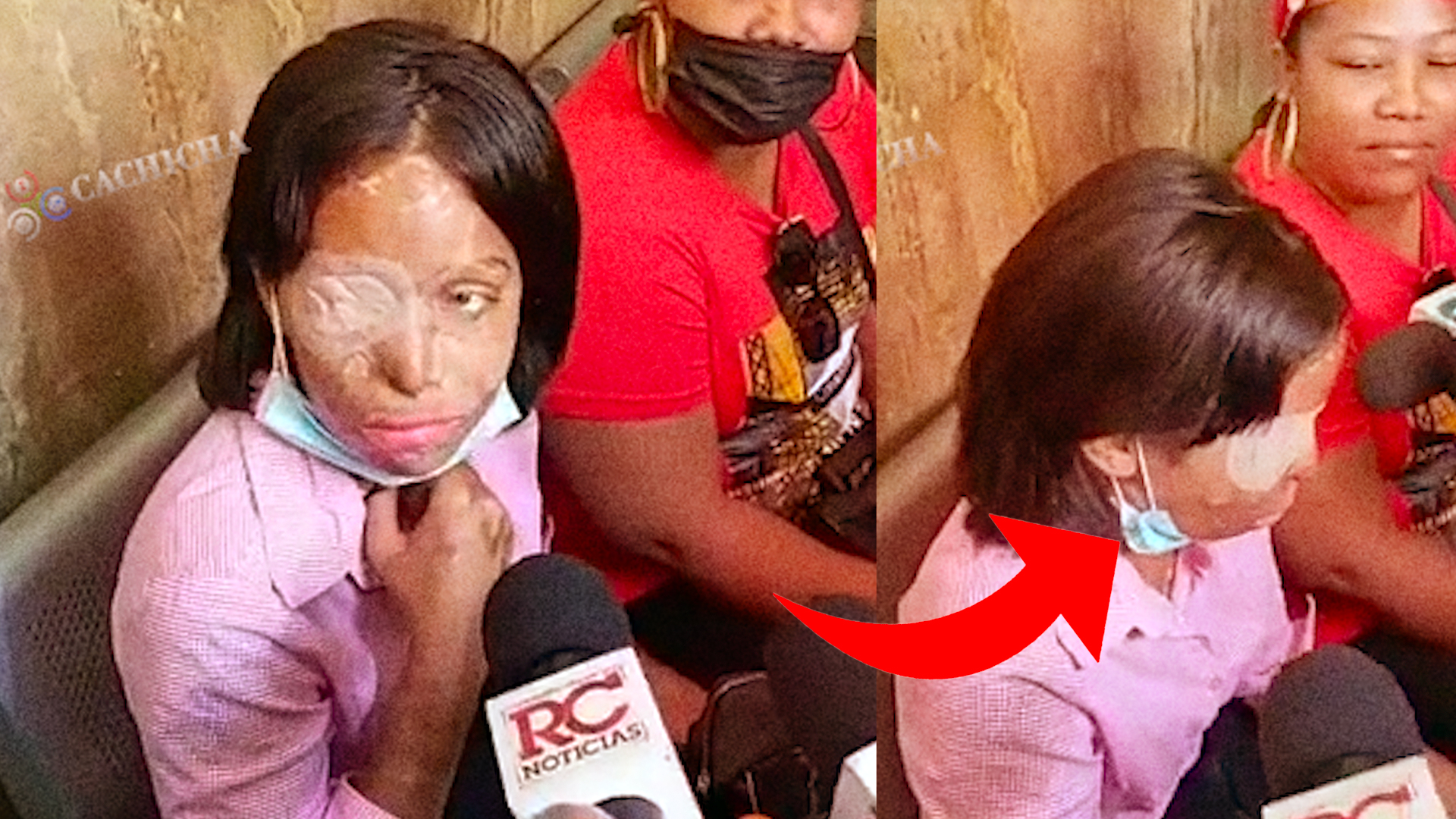 Esto Es Lo Que Yocairi Quiere Que Le Hagan A Sus Agresores; Doloroso Momento