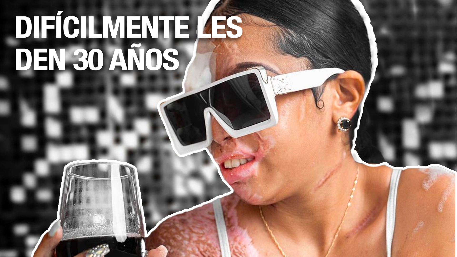 La Terrible Razón Por La Que Tal Vez No Condenen Por 30 Años A Quienes Rociaron Con Ácido A Yocairi